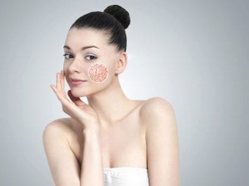 Laser Skin Treatments Department
